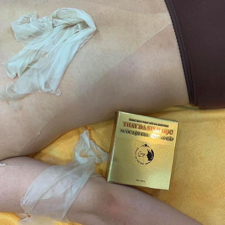 lột da body tay cổ cao cấp 30p kèm dưỡng ẩm , kích bong lần 2 8