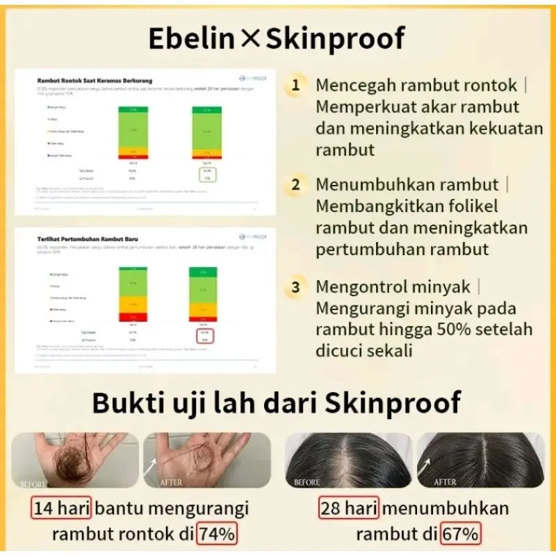 EBELIN SHAMPOO ANTI HAIR FALL SHAMPOO 300ML GINSENG ALAMI MENGATASI RAMBUT RONTOK PERAWATAN RAMBUT SHAMPOO GINSENG ALAMI 5