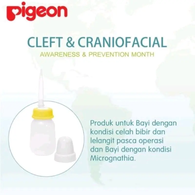 Pigeon Feeder With Long Silicone Nipple / Botol Susu Biibir Sumbing 1