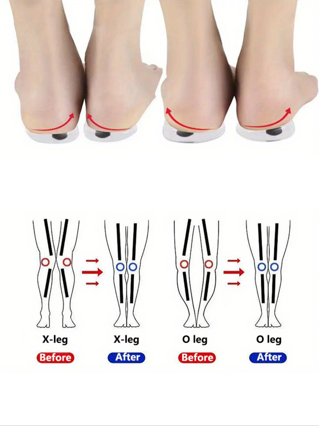 1 Pair Shoe Insoles, Women's O/X Leg Shoe Pad, Magnetic Heel Cushion, Arch Support Insoles, Anti-slip Shoe Inserts For Women & Men