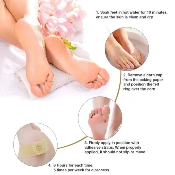 MQ 24 PCS Medicated Corn & Callus Removal Patches Salicylic Acid Foot Treatment Plasters Penghilang Kulit Keras Tanpa Sakit untuk Dewasa di Atas 16 Tahun