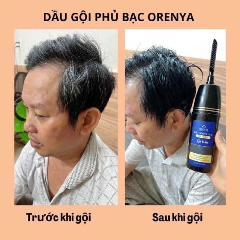 Product Introduction of Gôi phủ bạc 4