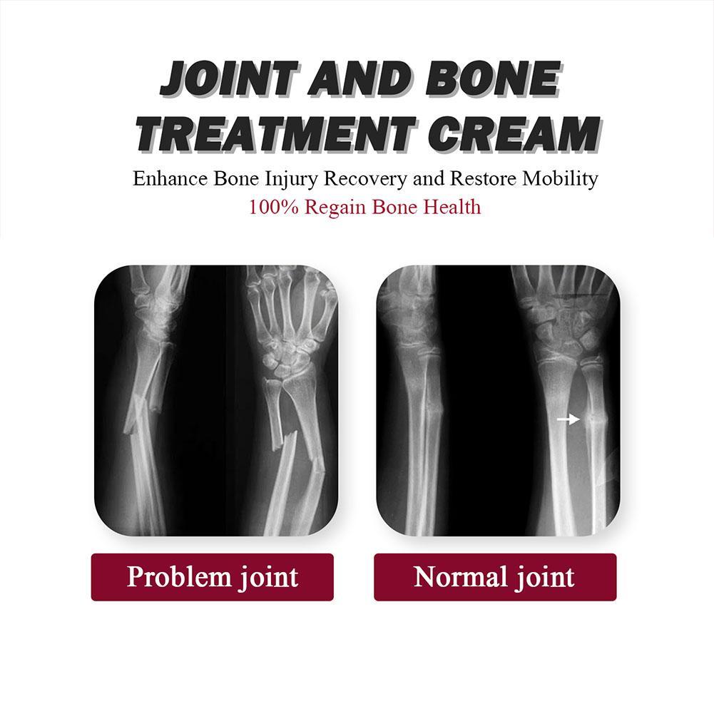 South Moon Joint Bone Therapy Intensive Concentrate Dan Pengobatan Terapi Sendi Krim Pereda Y9R3