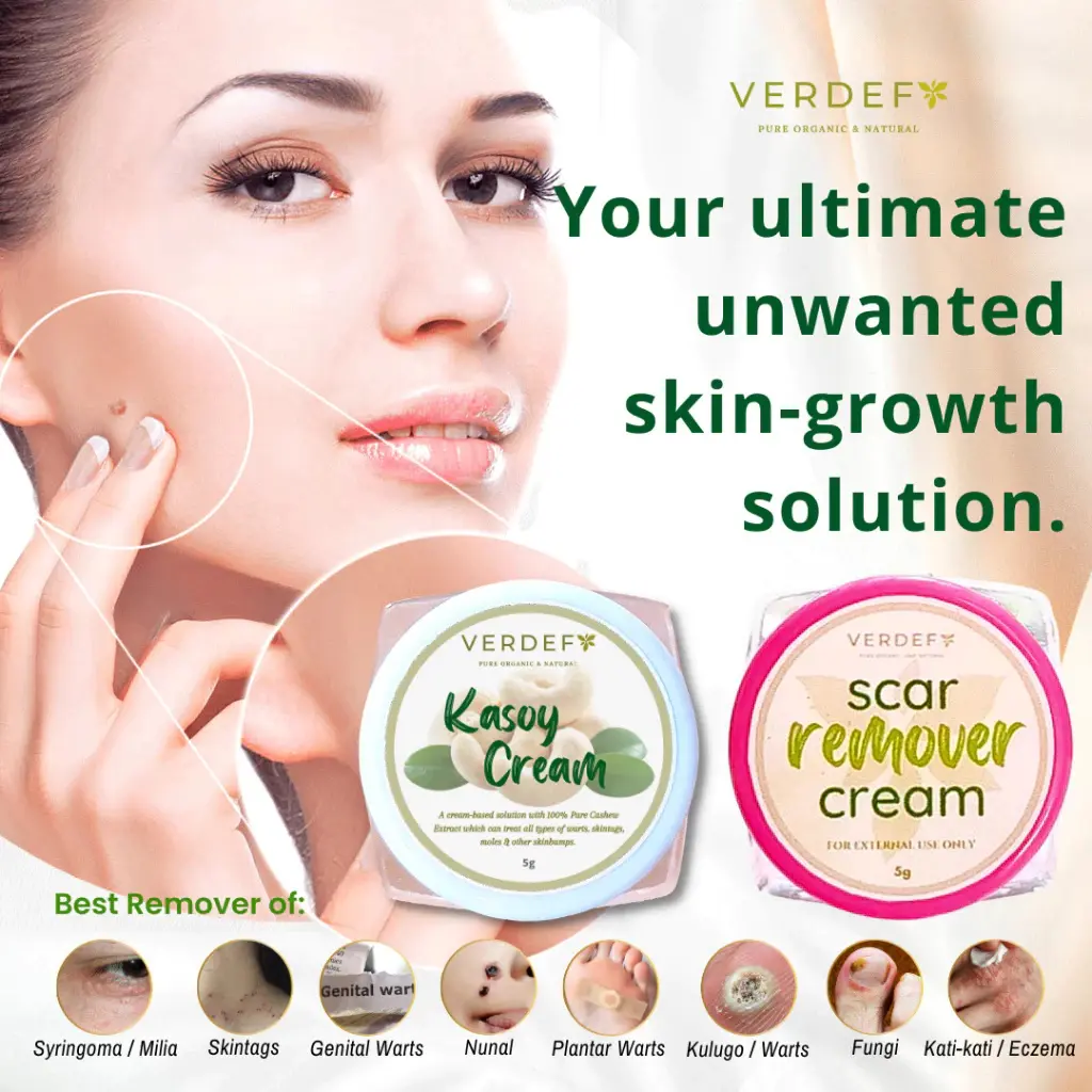 STRONG KASOY CREAM & SCAR REMOVER CREAM SET EFFECTIVE REMOVER OF MOLE WARTS SKIN TAG MILIA SYRINGOMA