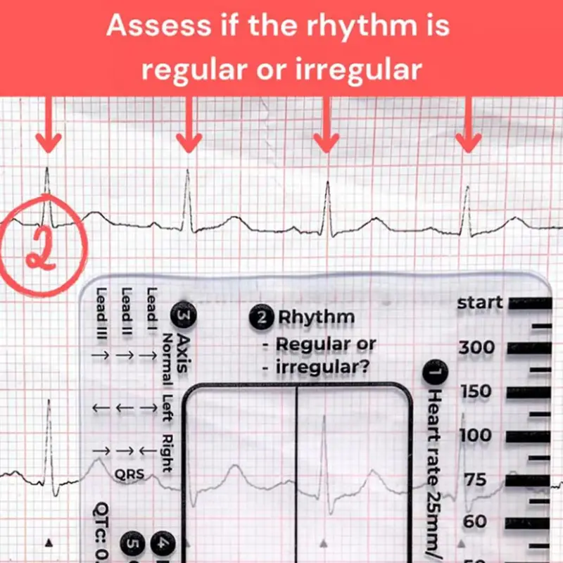 Thước 7 Bước, Cầm Tay, Hướng Dẫn Tham Khảo Bỏ Túi Giải Thích Ecg, Trong Suốt, Thiết Kế Nhỏ Gọn, Dụng Cụ Đánh Giá, Để Đo Lường 3