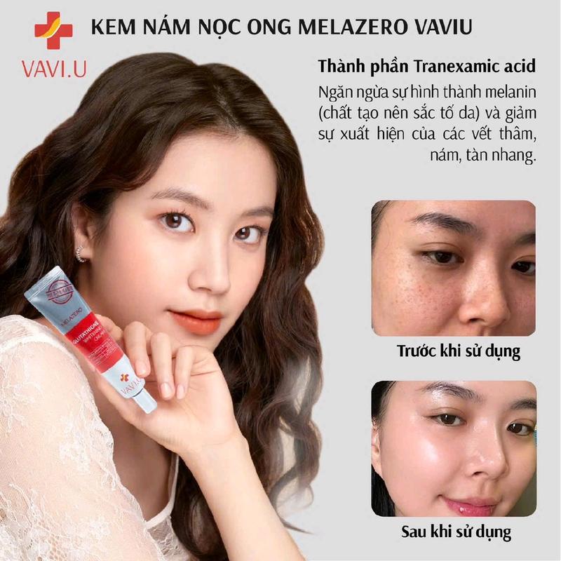 kem nám nọc ong Melazero vaviu 4