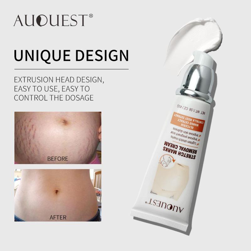 Product Introduction of Kem Trị Sẹo Và Mụn Trứng Cá, Loại Bỏ Vết Rạn Da, Chống Lão Hóa, Chống Nhăn, Làm Săn Chắc, Kem Dưỡng Thể, Thích Hợp Cho Phụ Nữ Mang Thai, Điều Trị Vết Co Giãn Da 27