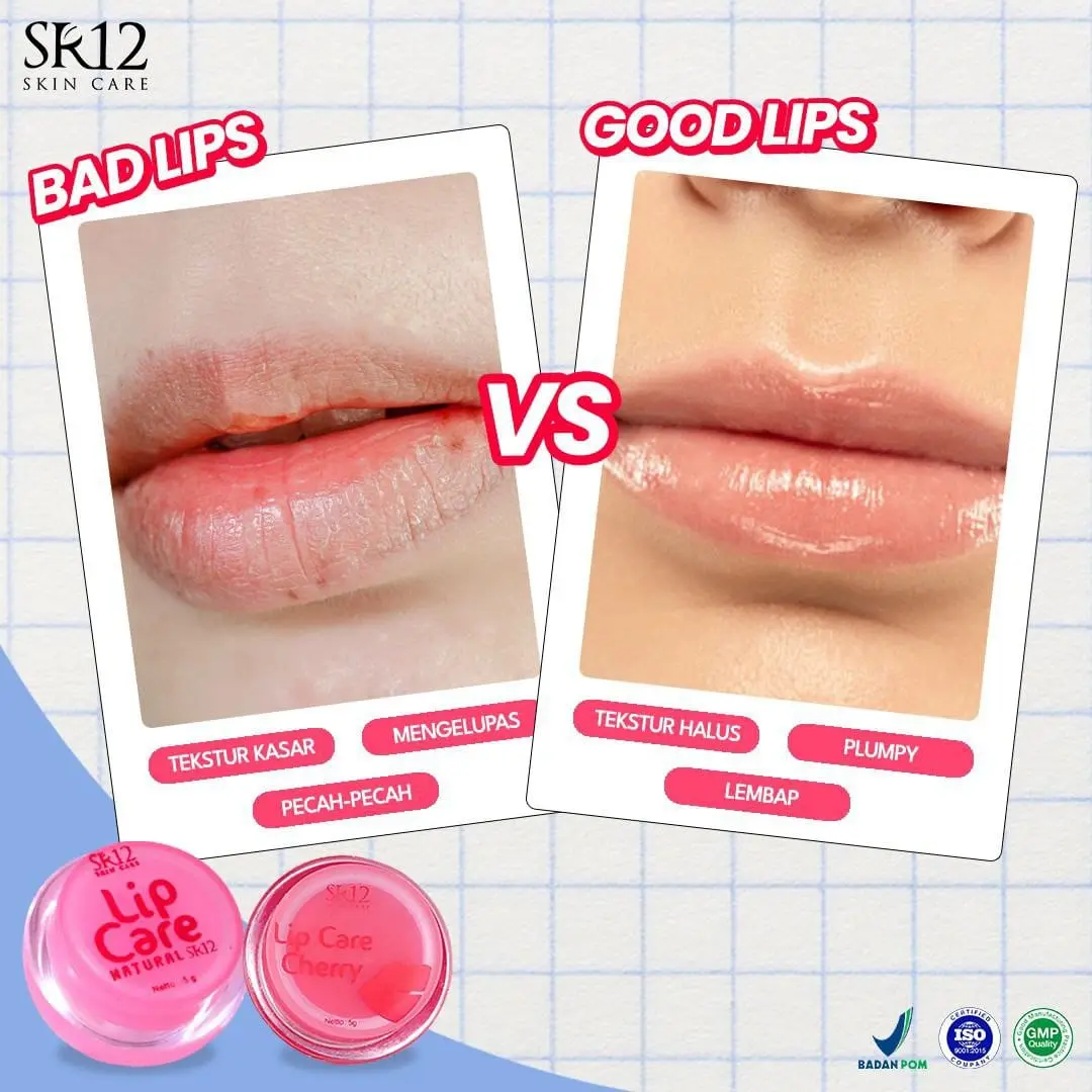 SR12 Lip Care Natural & Cherry Menyembuhkan Bibir Pecah-pecah dan kering melembukan mencerahkan kehitaman