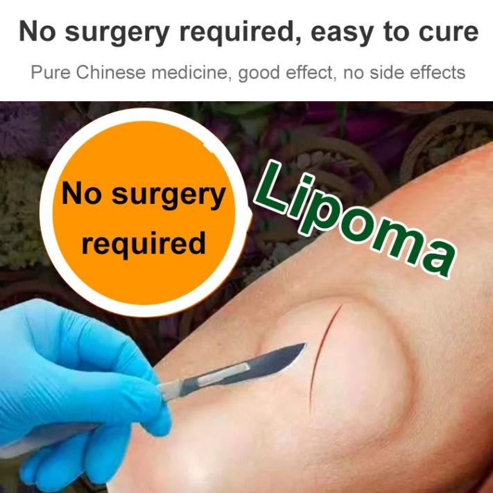 Salep Lipoma [IMPORT ASLI] Krim Lipoma Benjolan di Tubuh Penghancur Benjolan Kelenjar Getah Bening