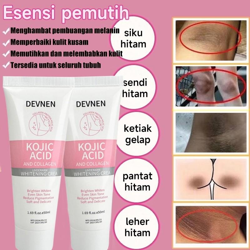 Kojic Acid Cream Pemutih Ketiak  Cream 50g Memutihkan bagian pribadi Pemutih Badan Cepat body lotion krim pemutih tubuh 7