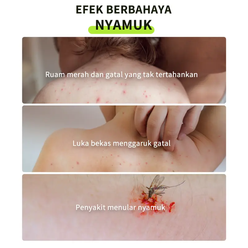 [3Pcs] ULA REFRESHING MIST 50ML*3 Repelling Mosquitoes [BPOM] with Sereh Oil External Use Only x FYC 3