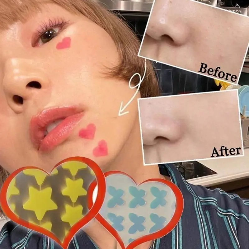 Acne patch lucu Pimple Patch Penghilang Jerawat Acnes Spot Care Plester Jerawat Acne Treatment 36 buah  stiker jerawat Cute Star/Heart Pimple Patch 2