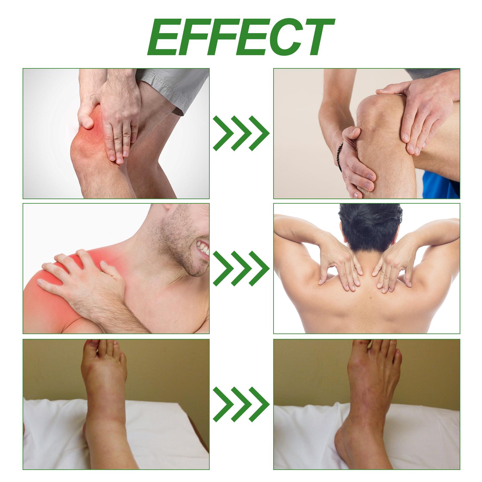 Ximonth Krim Perawatan Sendi, Pereda Nyeri Bahu, Leher & Lutut, Mengurangi Pembengkakan, Cocok untuk Cedera & Nyeri Punggung