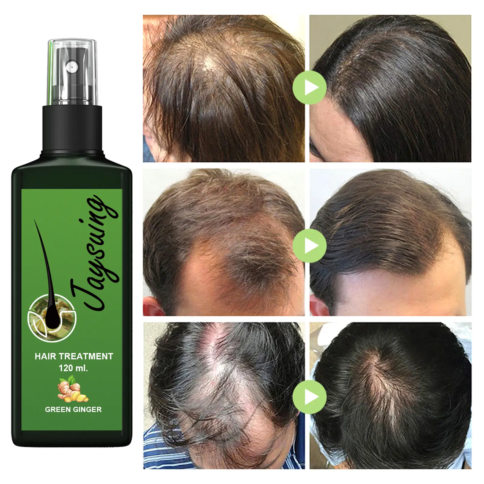 100% Original Brand JAYSUING Hair Care Solution Gentle Nourishing Massage Scalp Moisturizing Soft Spray