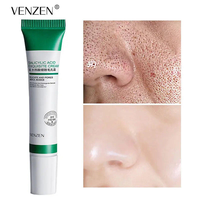Kem Tinh Chế Lỗ Chân Lông Axit Salicylic, 20ml, Thu Nhỏ Lỗ Chân Lông, Cải Thiện Mụn Trứng Cá, Mụn Đầu Đen Và Làm Trắng Da, Chống Lão Hóa, Kiểm Soát Dầu, Chăm Sóc Da