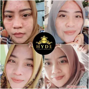 Hyde Beauty Skincare Facial Wash Glowing Terlaris