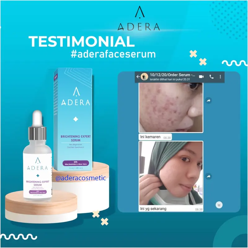 [ BISA COD ] SERUM PENGHILANG FLEK/SERUM WAJAH PENGHILANG JERAWAT/Serum Adera wajah glowing flek hitam/ SERUM WAHITENIG TERBAIK DALAM 3 HARI/SERUM PENGHILANG FLEK/SERUM WAJAH GLOWING BPOM ORIGINAL Adera Anti Acne Serum Original BPOM  Lapak_Cantik87 6