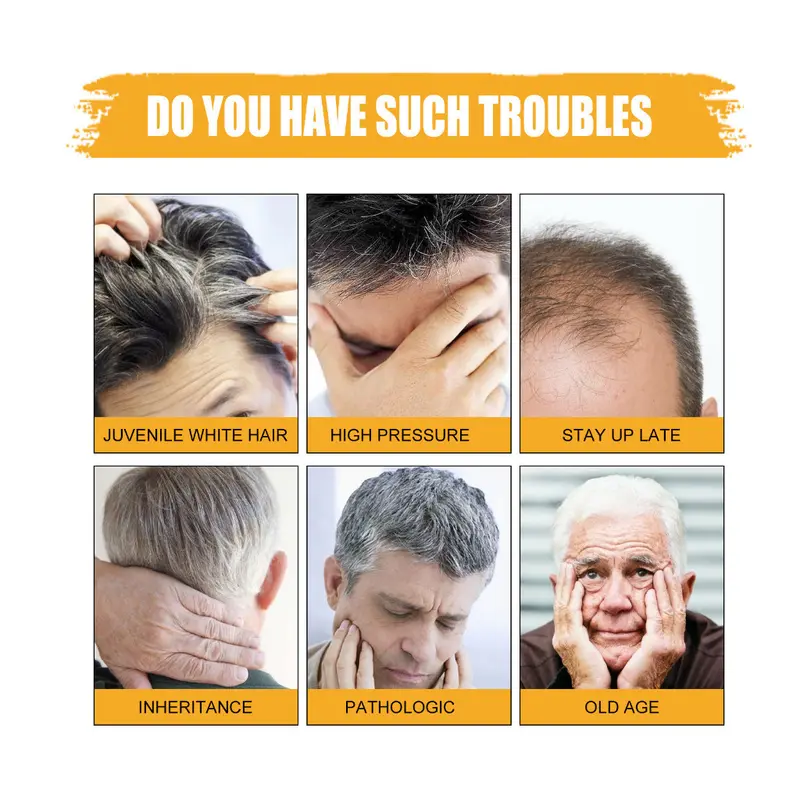 Rambut Hitam Sabun Penggelap Rambut Sabun Sampo Bar Penggelap Polygonum Essence Hair Darkening Shampoo Bar Soap Black Pomade Penghilang Uban Penyamar Rambut Putih Pomade Hitam 5
