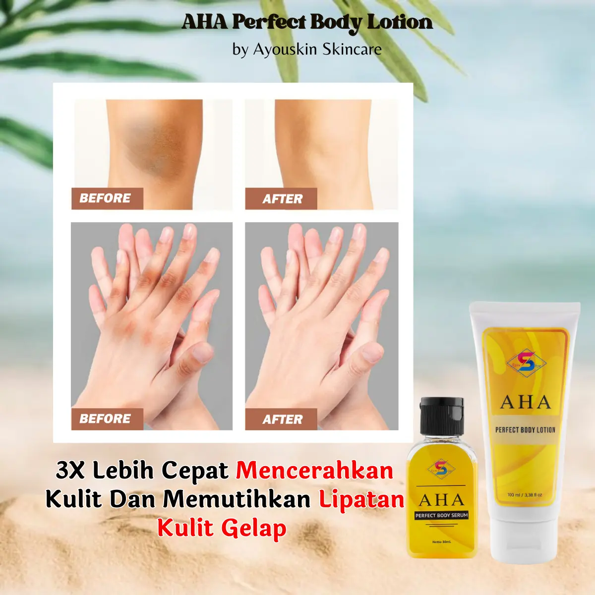 Body lotion Pemutih Memutihkan Lutut Hitam, Tangan Gelap, Cream Pemutih Jari Tangan Gelap, Lotion Pemutih Badan Whitening, Mencerahkan dan Melembab kulit kering, kusam  [Bpom]