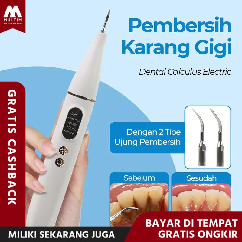 MultiM YUKU Pembersih Karang Plak Gigi Ultrasonic Dental Calculus Electric - GS5 0