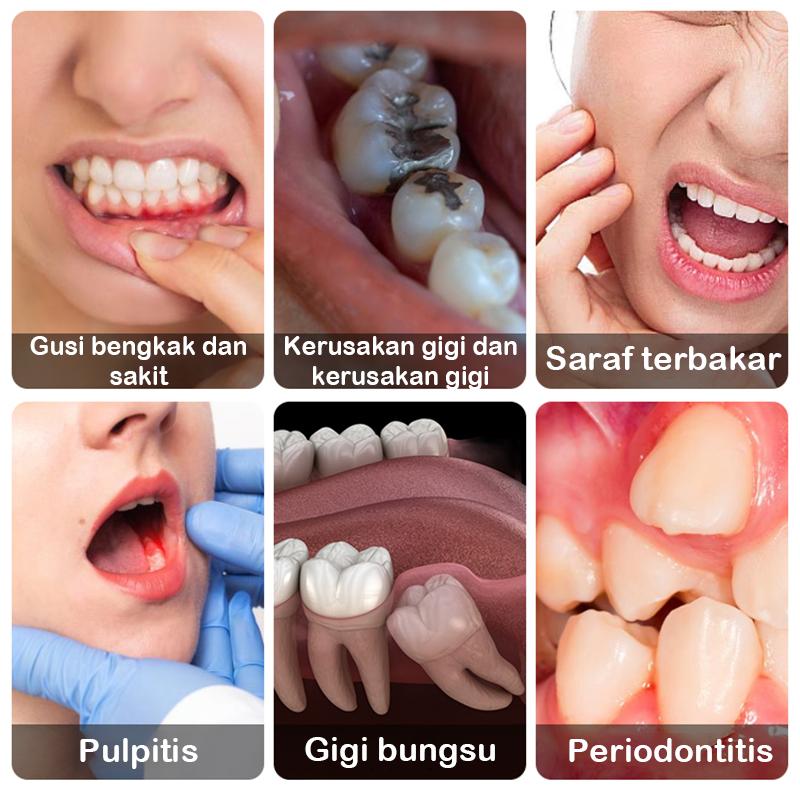 Japan Obat Sakit Gigi Berlubang Paling Ampuh Penghilang Gusi Bengkak Linu Ngilu Bernanah Nyeri Sariawan Anak Dewasa Cairan Tetes-Obat Gusi Bengkak Nyut Nyutan 20ml [B58]