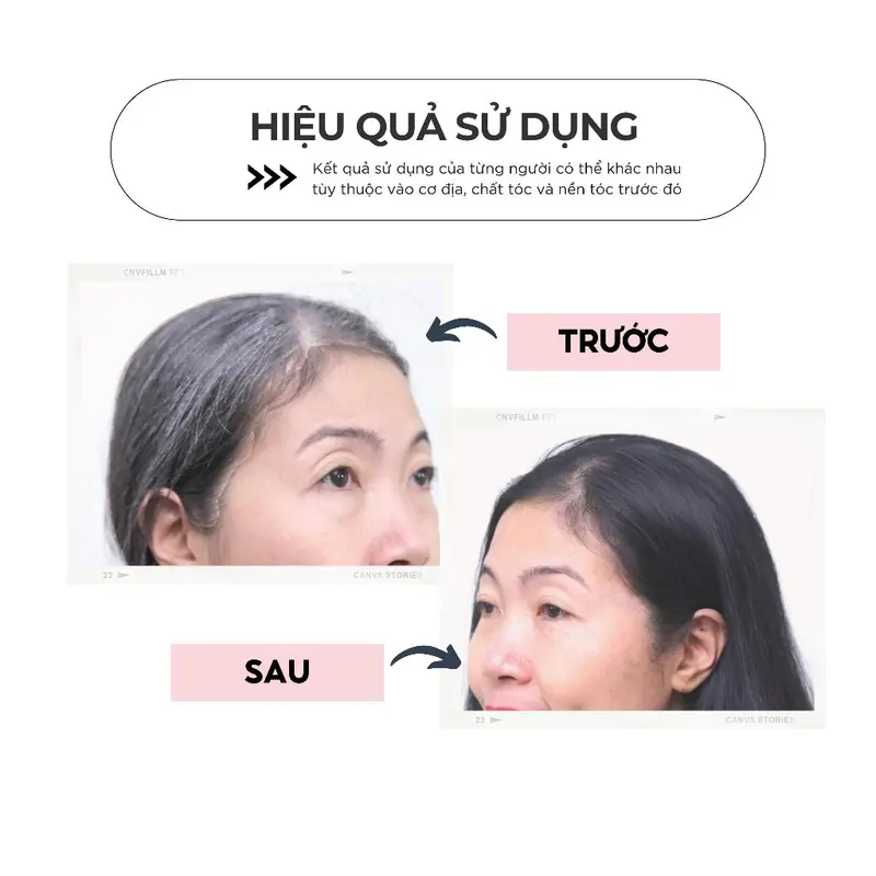 Dầu gội đen tóc 1 GÓI - Phủ bạc tại nhà đen tóc Gội là đen tigi, nhân sâm Hàn 3