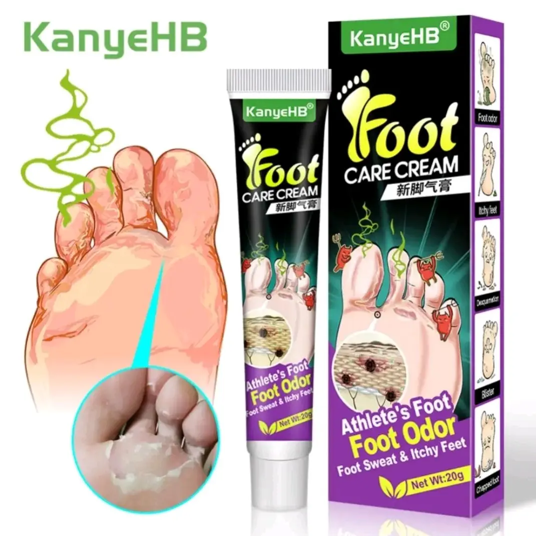KanyeHB Foot Balm Cream for Itchy Toes, Moist Feet, Foot Fungus, Hong Kong Foot