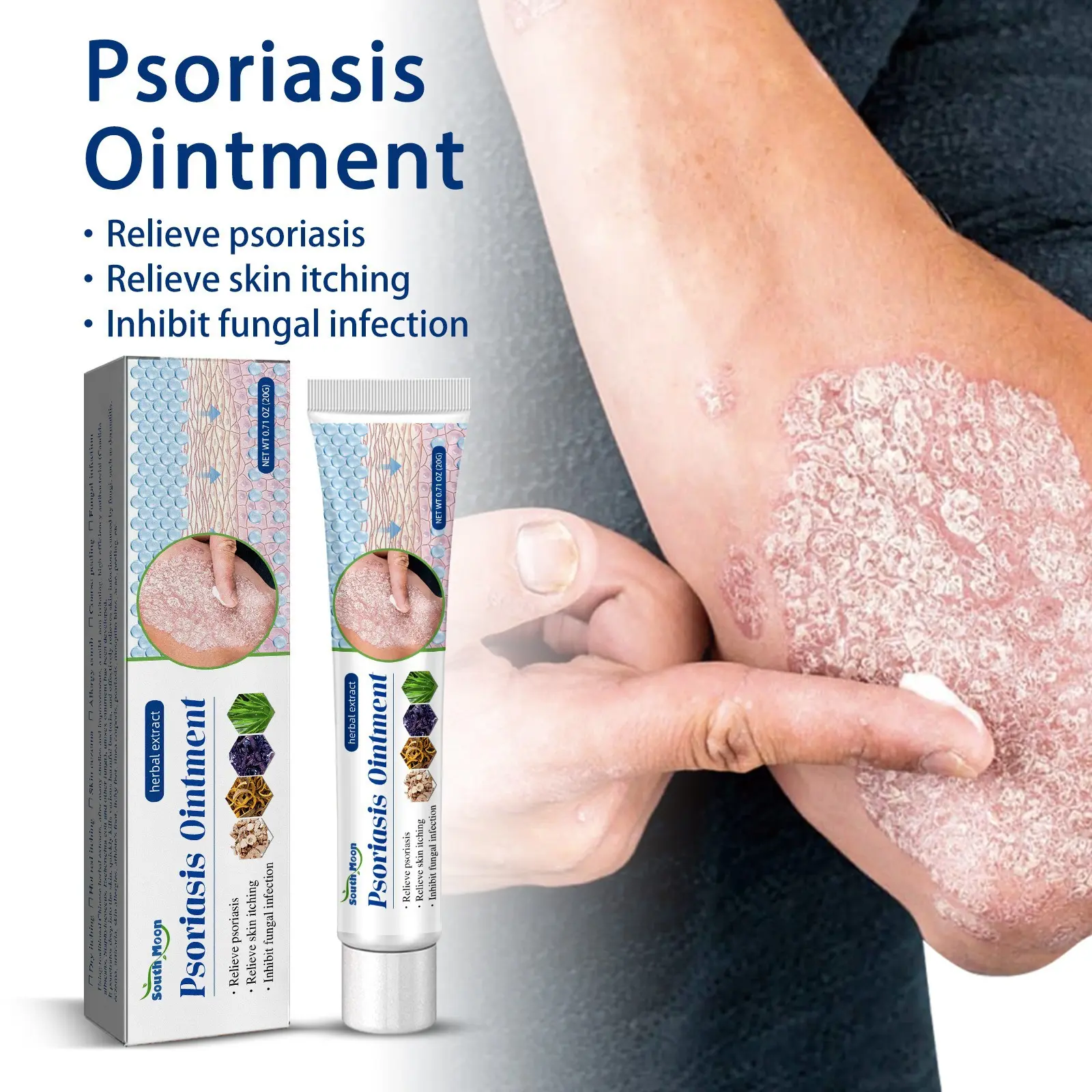 7 Days Effective 100% Effective Herbal Psoriasis Dermatitis Eczema ...