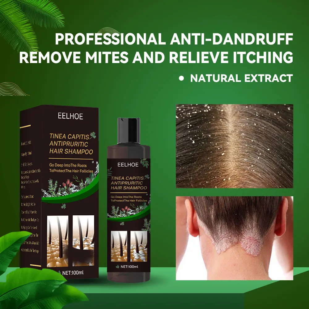 Anti-itch Soft Shampoo, Anti-dandruff Shampoo, Refreshing and Nourishing Shampoo that removes mites, reduces hair follicle damage, and prevents dandruff recurrence.