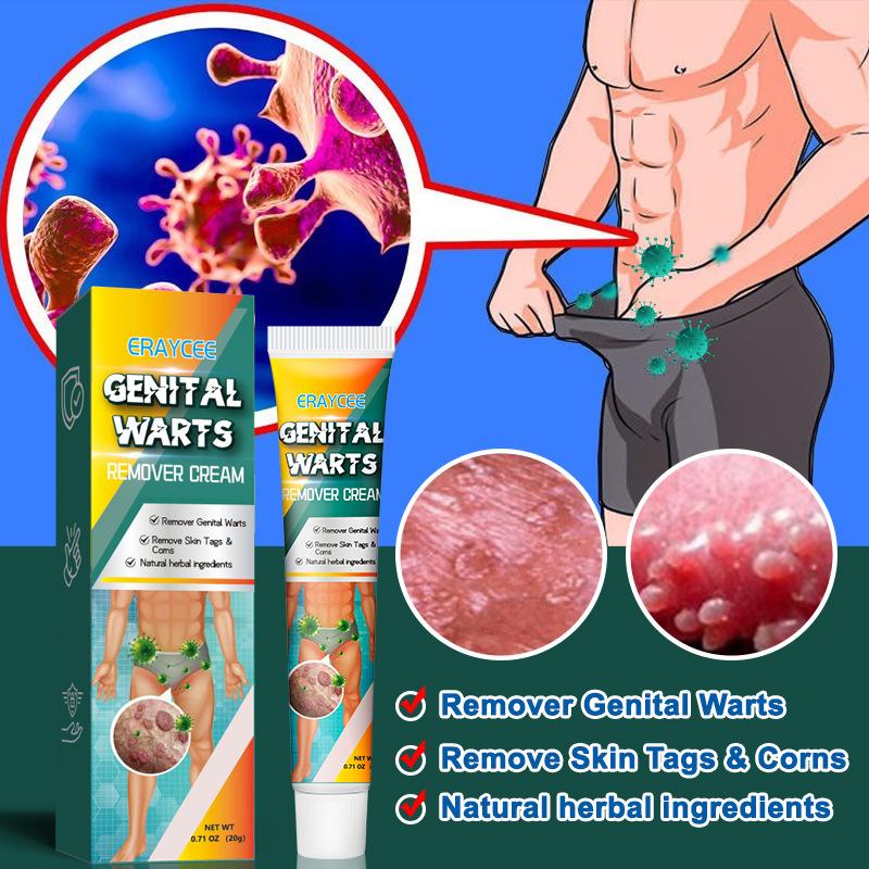 Product Introduction of Kem Loại Bỏ Mụn Cóc Thảo Dược, Dành Cho Nam Và Nữ, Sử Dụng Trên Khu Vực Riêng Tư, Pinghou You, Hiệu Quả 9