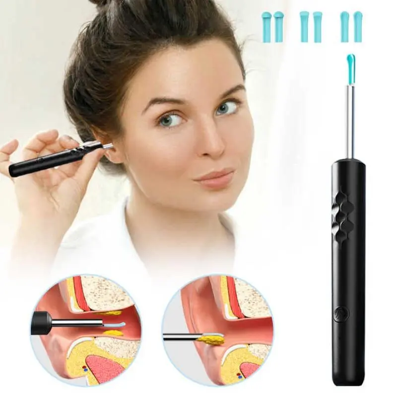 Electric Ear Wax Removal Kit, 1 Set Visible Ear Cleaner with Camera & Accessories, Ear Wax Removal Tool, Ear Cleaning Tool for Adults & Kids 5