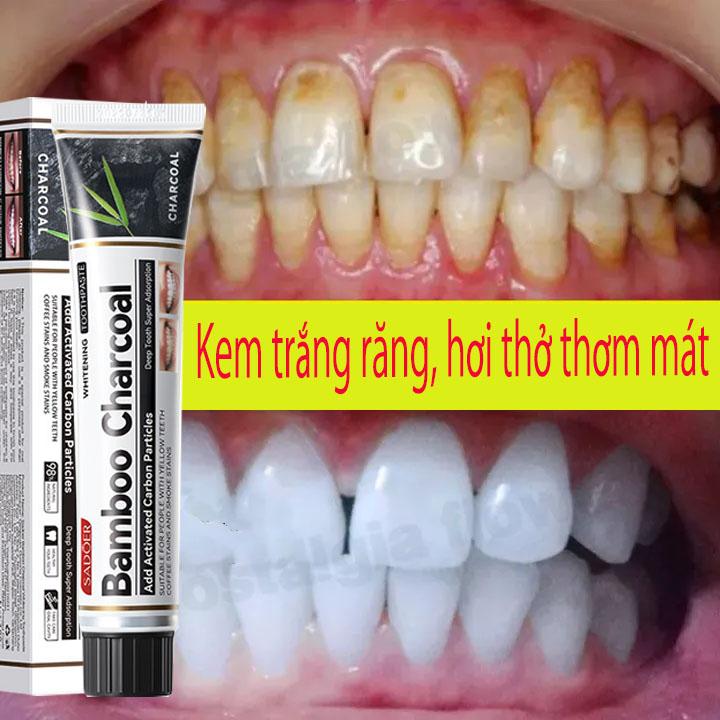 Kem Đánh Răng Làm Trắng Răng loại bỏ cao răng hôi miệng tẩy ố vàng Không Chứa Florua Kem đánh răng bạc hà 100g 0