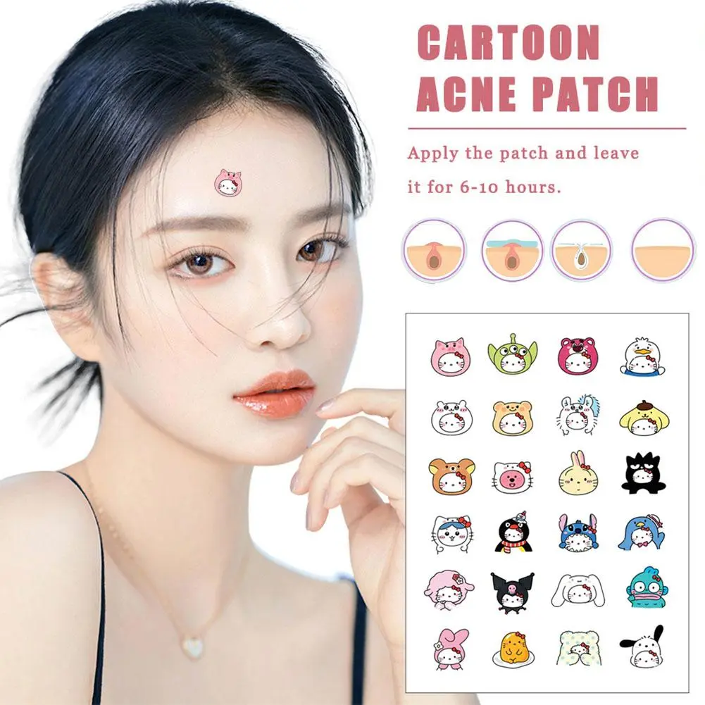 Miếng Dán Mụn Hoạt Hình, 20 Chiếc, Hình HelloKitty Sanrio, Miếng Dán Mụn Che Mụn Vô Hình Loại Bỏ Mụn Trứng Cá, Chăm Sóc Da