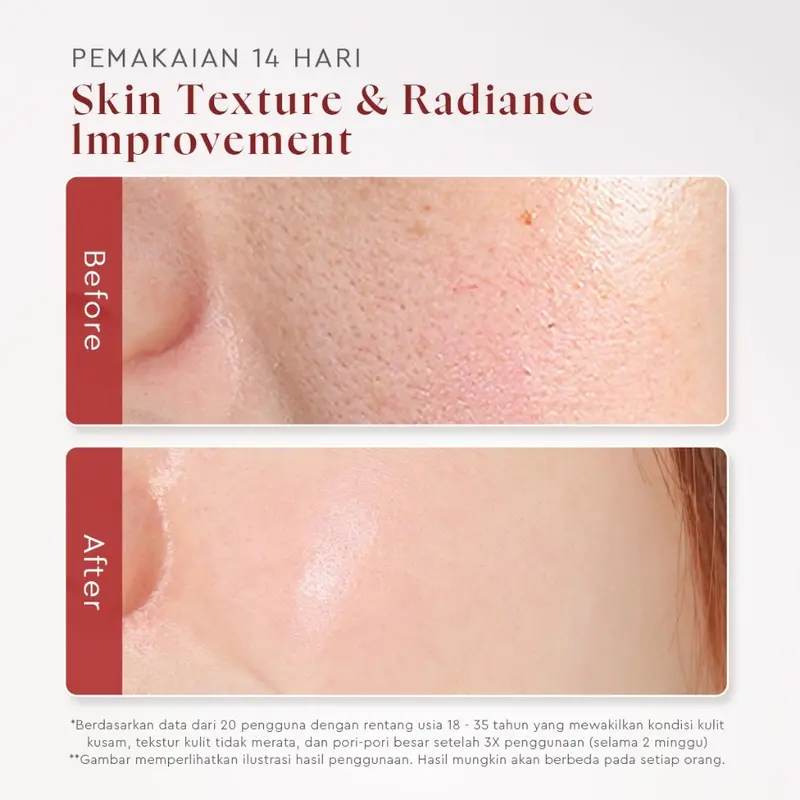 GLAD2GLOW AHA BHA PHA Intensive Peel Solution Serum Lactic Acid Serum Exfoliasi Wajah 4