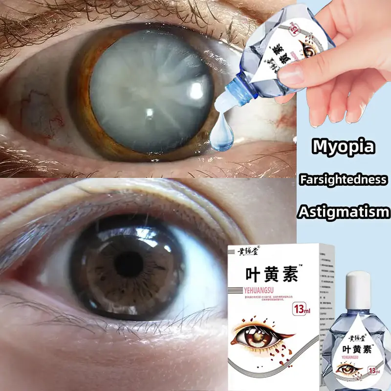 Herbal Eye Drops for Cataracts, Eye Drops for Cataracts, Relieve Dry Eyes, Itchy Eyes, Red Eyes, and Tired Eyes, Eye Care 13ml