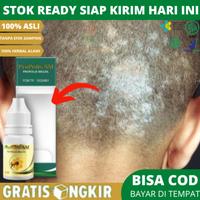 Gambar Penghilang Gatal Jamur Di Kulit Kepala Dengan Propolis SM 100% Original Herbal Alami - Propolis SM dari Alhikmah Toko Herbal Kota Administrasi Jakarta Barat 1 Tokopedia