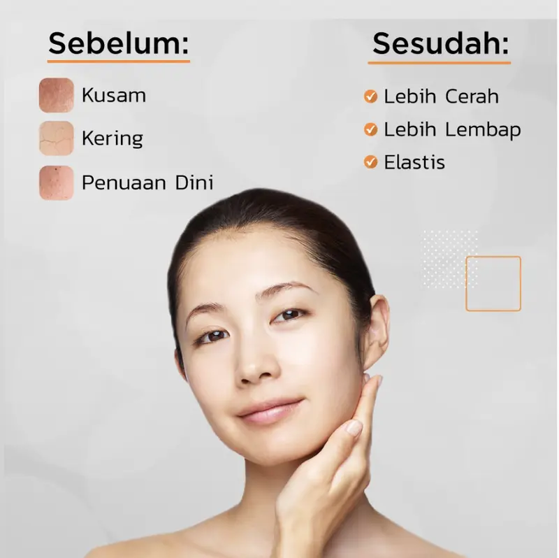ERHA Bundling Collagen Mask 4 pcs - Masker Kolagen Anti Aging & Pencerah 2