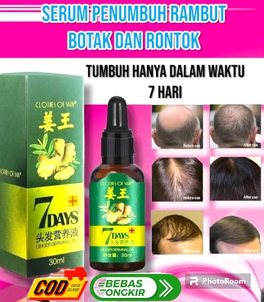 ️️BIG SALE️ ️ORI [PENUMBUH RAMBUT BOTAK] Essence Anti Rontok / Botak Asli Obat Uban Penghitam Penyubur Original 0