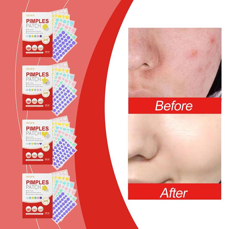 Product Introduction of 240pcs Salicylic Acid Acne Patch Colorful Heart Star Acne Shaped Pimple Patch N6S9 19