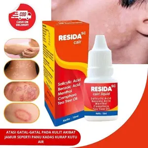 RESIDA LIQUID CAIR ISI 10 ML- UNTUK JAMUR PANU KADAS KURAP KUTU AIR GATAL