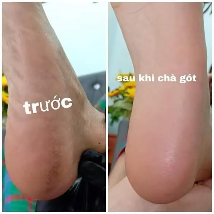 ￼Máy Chà Gót Chân Tẩy Tế Bào Chết Tự Động Tại Nhà, Sạc Pin Tích Điện 5