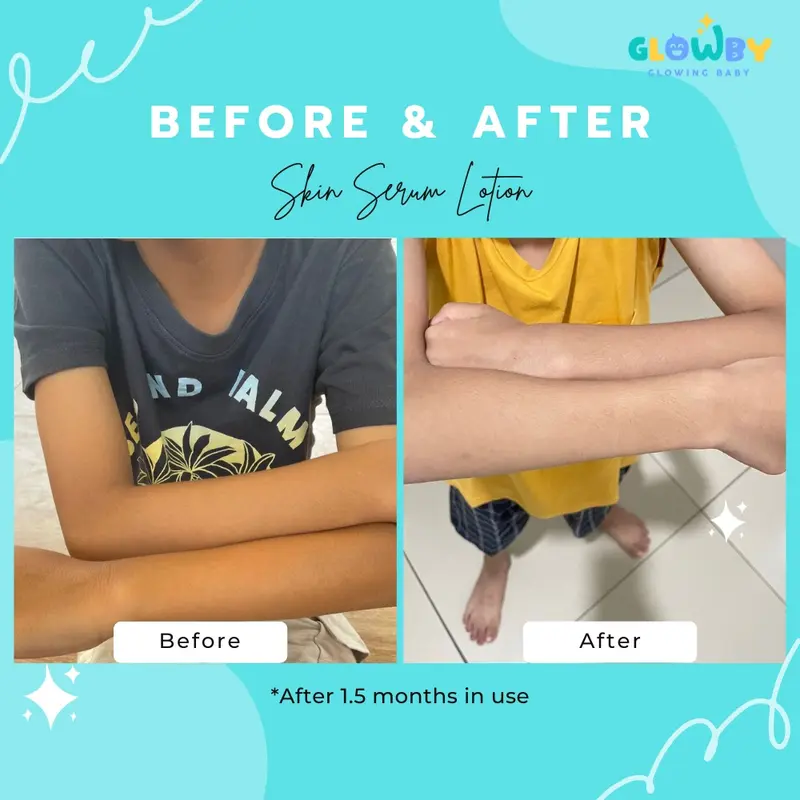 Glowby Skin Serum Lotion Pencerah Kulit Bayi dan Anak 1