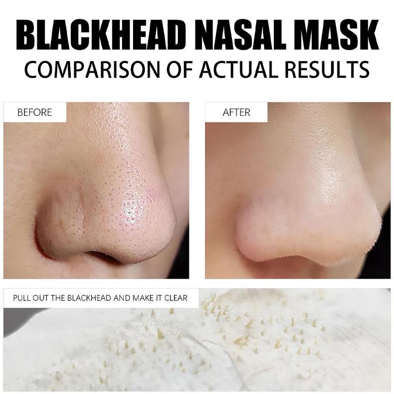 Blackhead Removal Nasal Mask Deep Cleaning Face Remove Blackheads Acne Shrink Pore 6