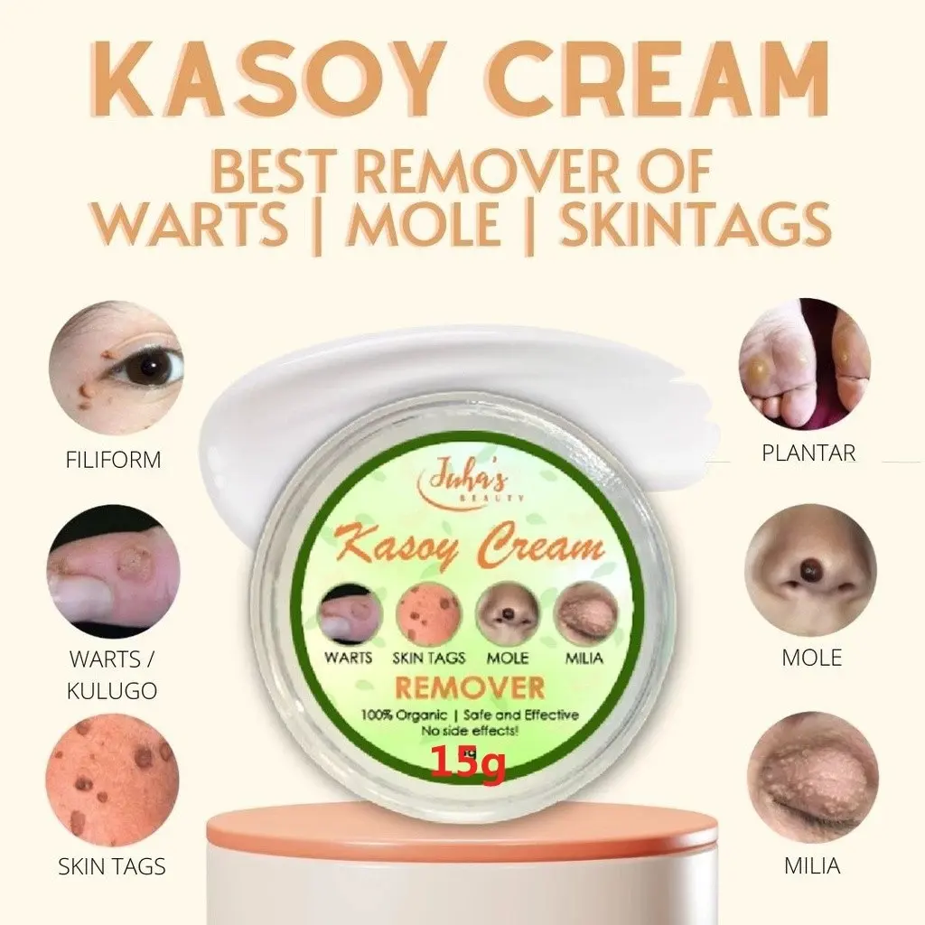 Jaha's Kasoy Cream 100% Original Kasoy Cream Remover