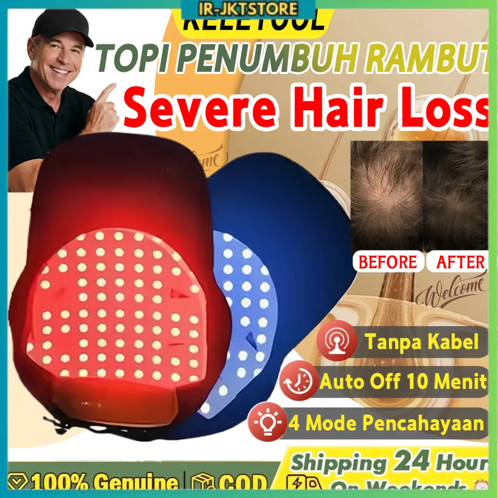 Topi Laser Penumbuh Rambut – LED Red & Blue Light Hair Growth Therapy ...