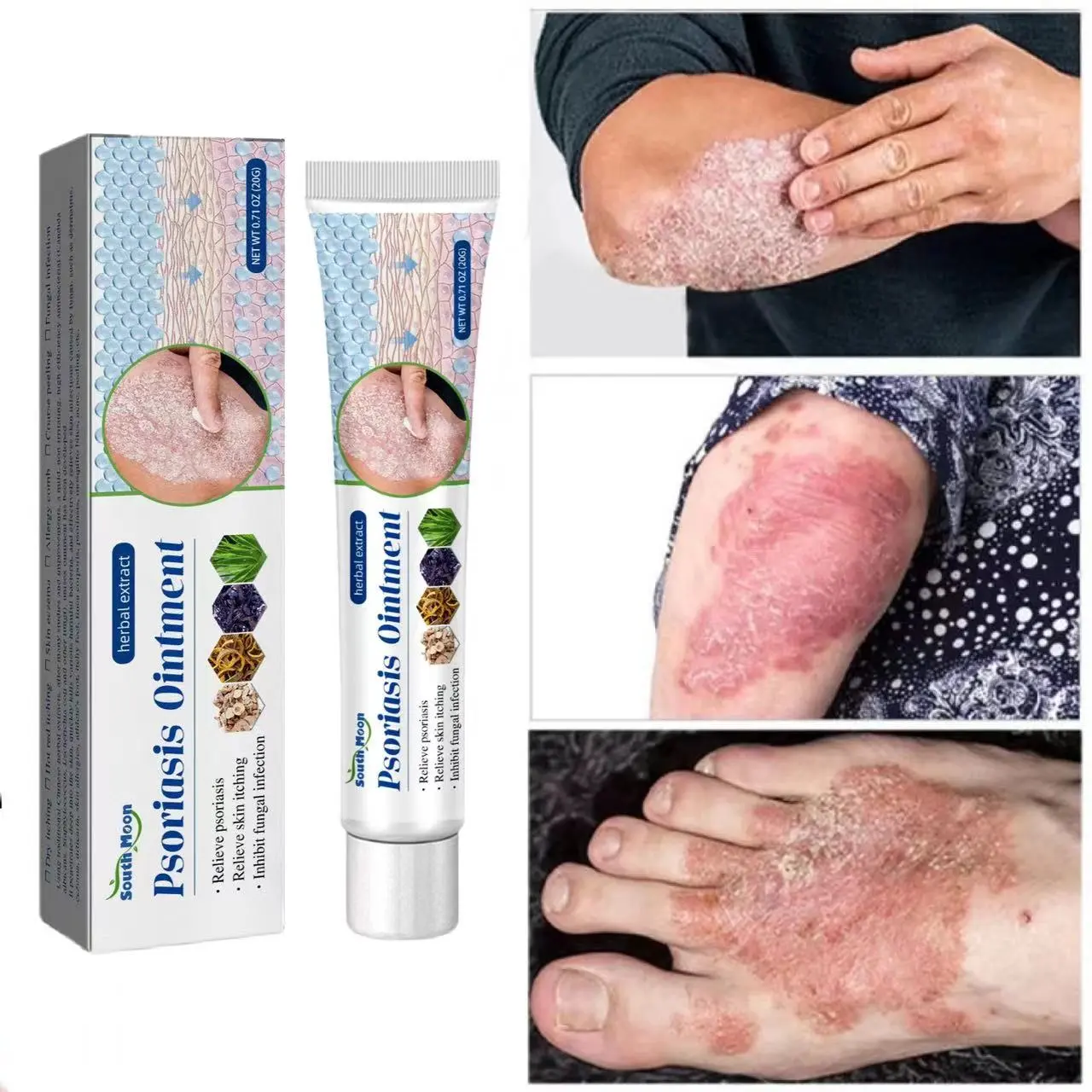 Salep khusus psoriasis ointment - import - kurap pada kulit kepala - kutu air - kurap pada badan - eksim - infeksi kulit - obat luar mengatasi gatal