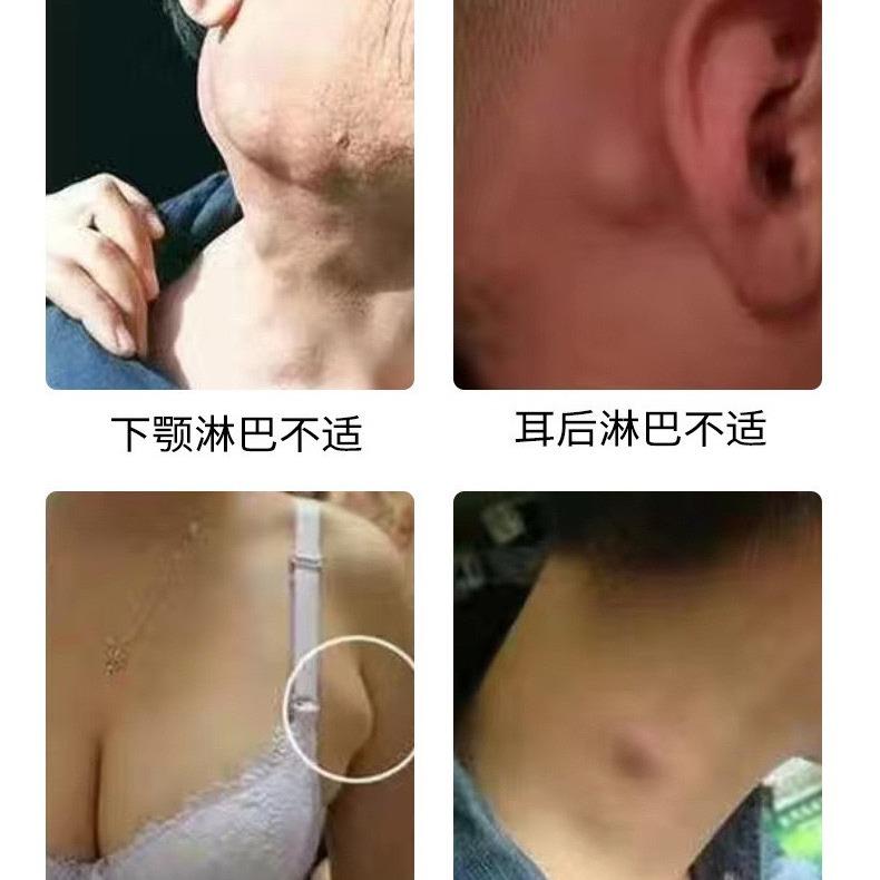 Kem chăm sóc sức khỏe tiêu tan hạch bạch huyết 1