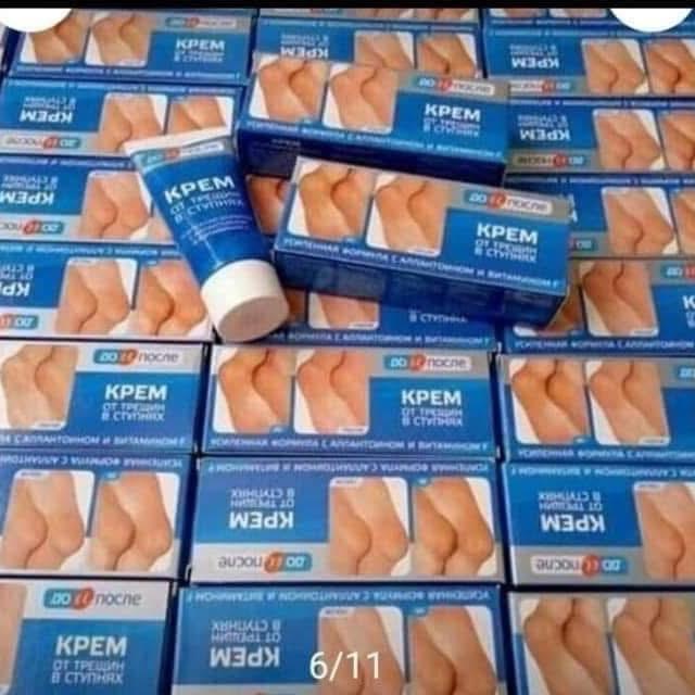 Kem bôi nứt , nẻ gót chân kpem hàng nga 50ml 3