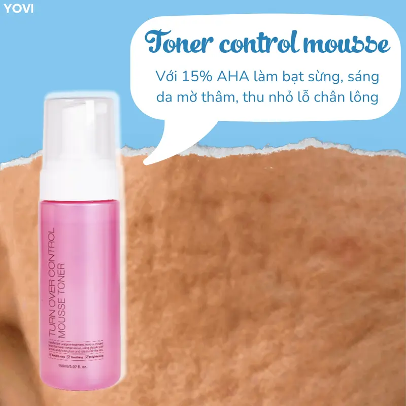 Toner Control Mousse làm sáng da, mờ nám thâm mụn, thu nhỏ lỗ chân lông 3
