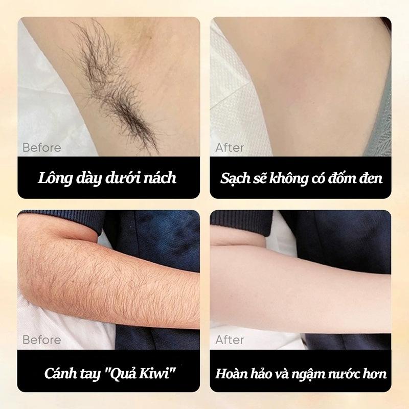 Kem tẩy lông SADOER , tẩy lông vùng kín, nách, tay, chân, triệt lông an toàn không đau rát dung tích 150ml ZYC11CSD1C 3